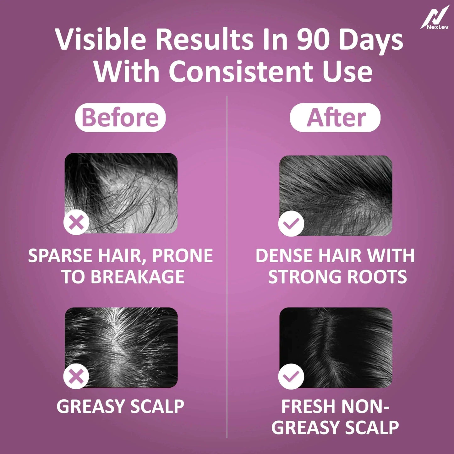 Luméra Hair Regrowth Red Light Comb